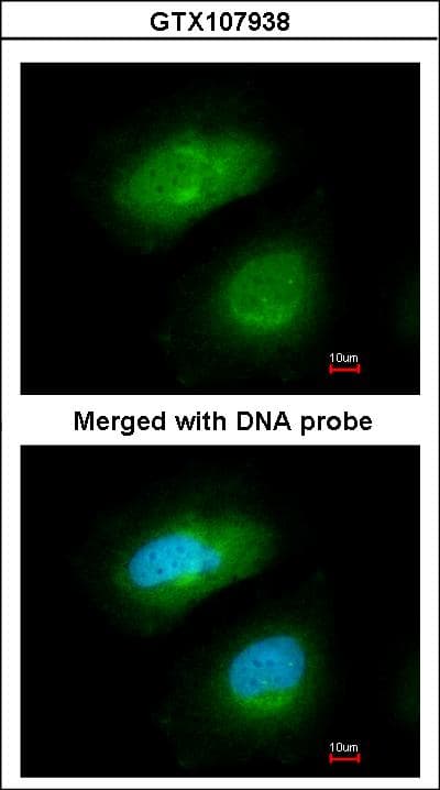 MAPKAPK5 / PRAK Antibody (aa197-457)