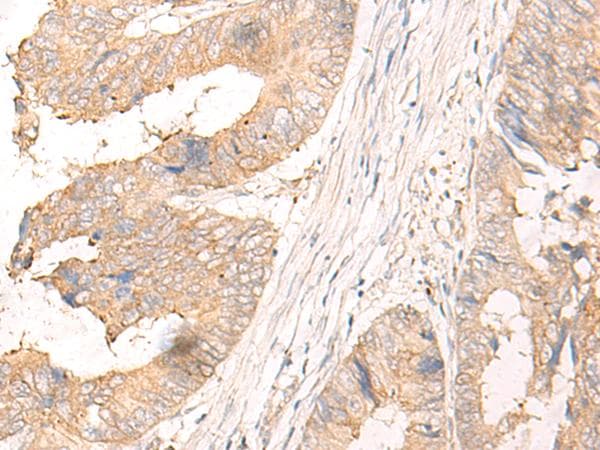 Polyclonal Rabbit anti-Human MYDGF / SF20 Antibody (IHC, WB)