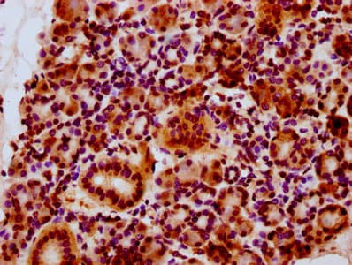 HIST1H2BN Antibody