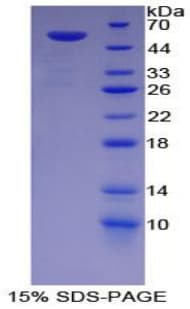 Rat G6PD Protein (Recombinant His)