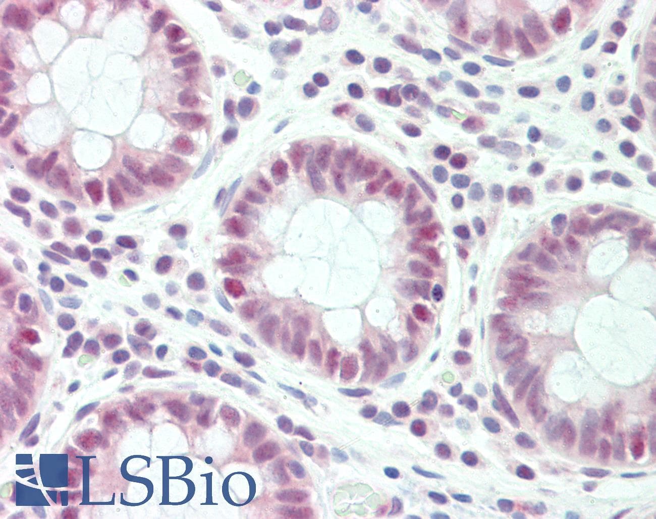 IHC-plus™ SLC4A1AP / Kanadaptin Antibody (aa421-470)