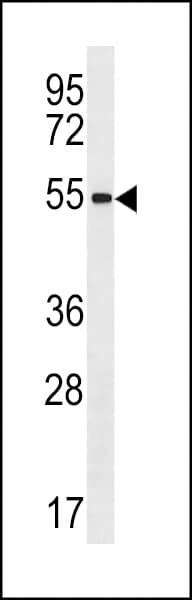 Polyclonal Rabbit anti-Human ZNF621 Antibody (aa103-130, WB)