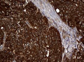 NME1 / NM23 Antibody (clone OTI4H2)