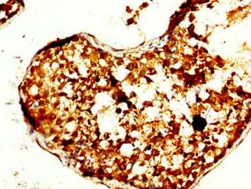 Polyclonal Rabbit anti-Human TOM1L1 Antibody (IHC, IF)