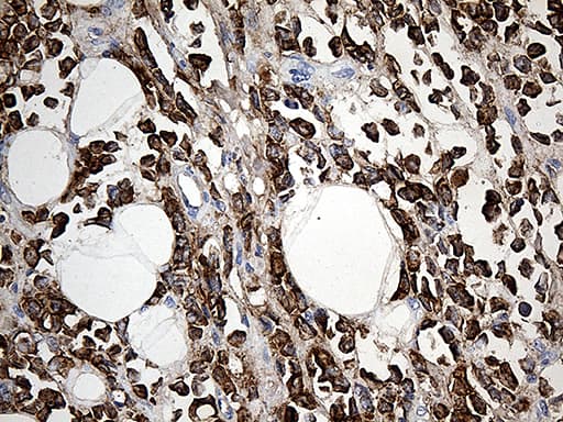Monoclonal Mouse anti-Human TFF1 / pS2 Antibody (clone OTI1A4, aa25-84, IHC, WB)