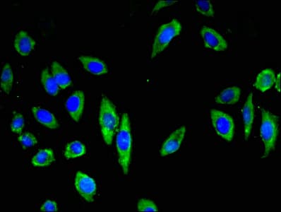 Polyclonal Rabbit anti-Human CDH18 / Ey-Cadherin Antibody (IHC, IF, WB)