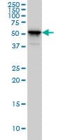 PathPlus™ KRT4 / CK4 / Cytokeratin 4 Antibody (clone 5H5)