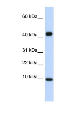 CCL8 / MCP2 Antibody (C-Terminus)