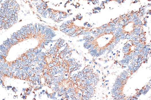 Polyclonal Rabbit anti-Human CD274 / B7-H1 / PD-L1 Antibody (IHC, IF, WB)