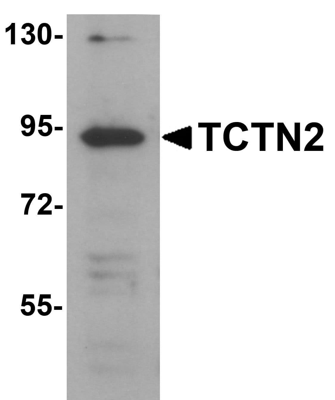 IHC-plus™ Polyclonal Rabbit anti-Human TCTN2 Antibody (IHC, WB)