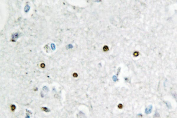 MSH6 Antibody (Glu371)