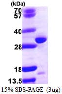 Human QDPR / DHPR Protein (Recombinant His)