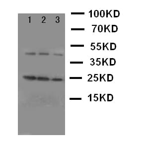 GH / Growth Hormone Antibody (aa27-216)