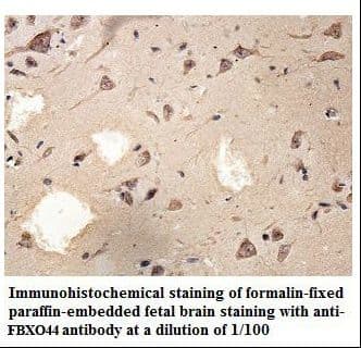 FBXO44 Antibody (aa86-190)