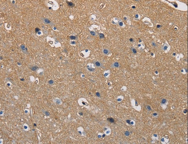 GSTA2 Antibody