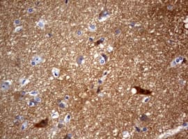 Monoclonal Mouse anti-Human VILIP / VSNL1 Antibody (clone OTI4C2, IHC, WB)