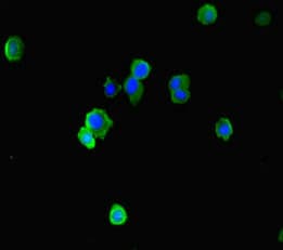 Polyclonal Rabbit anti-Human EAF2 / U19 Antibody (IHC, IF, WB)