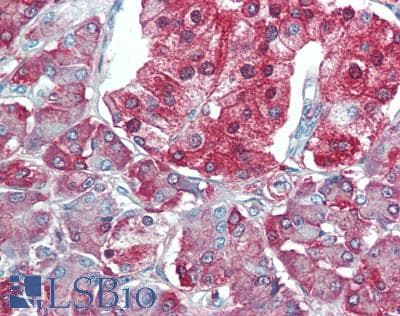 IHC-plus™ Polyclonal Rabbit anti-Human VEGFB Antibody (60-140 aa, Internal, IHC, WB)