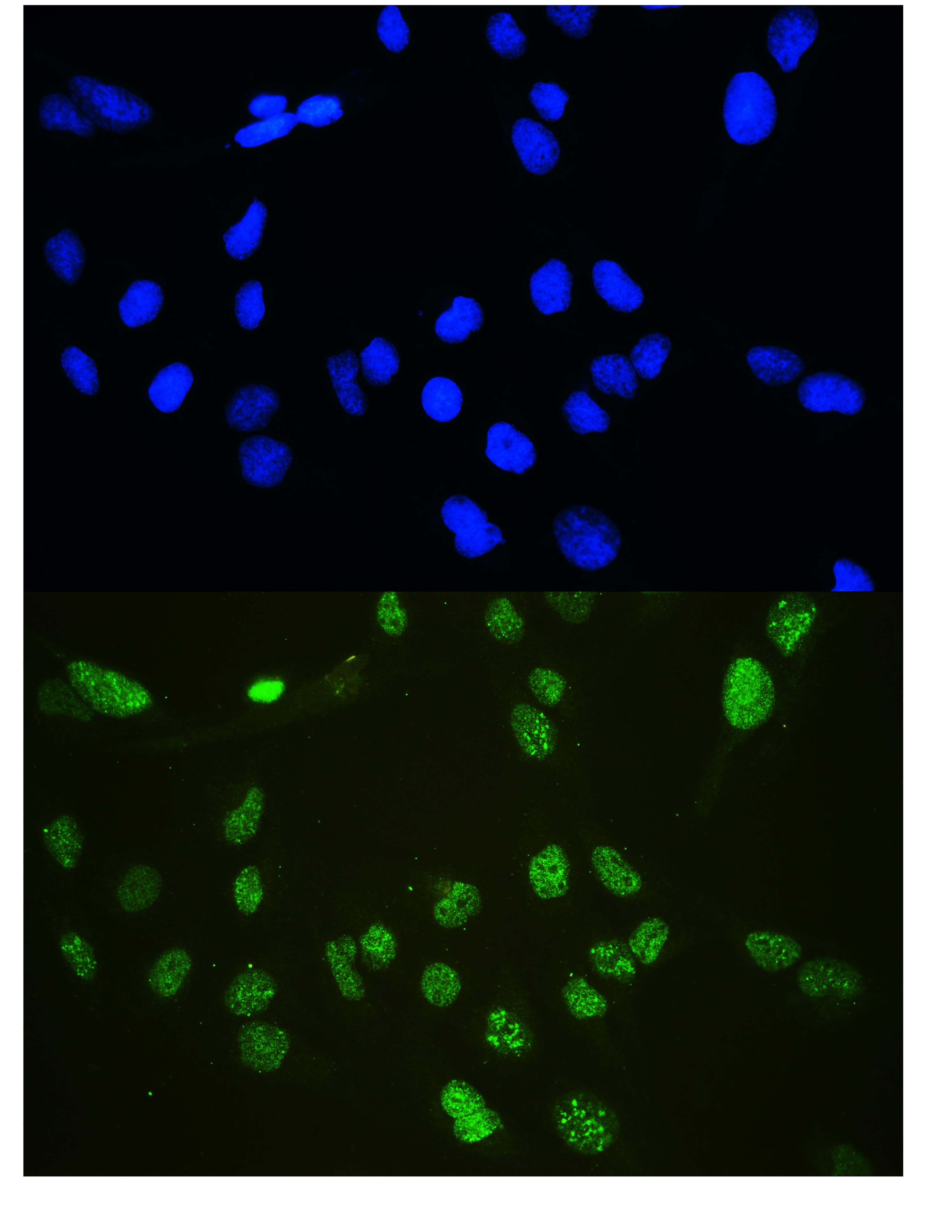 CDKN1B / p27 Kip1 Antibody (aa10-198)