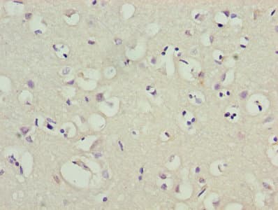 Polyclonal Rabbit anti-Human KCND1 / Kv4.1 Antibody (IHC, WB)