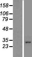CCDC101 Protein (Over-Expression Lysate Myc-DDK (Flag))