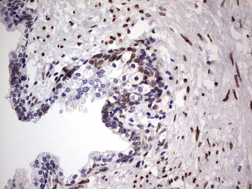 CSNK1E / CK1 Epsilon Antibody (aa153-416, clone OTI5D4)