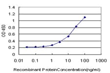 CNR1 / CB1 Antibody (clone 2F9)