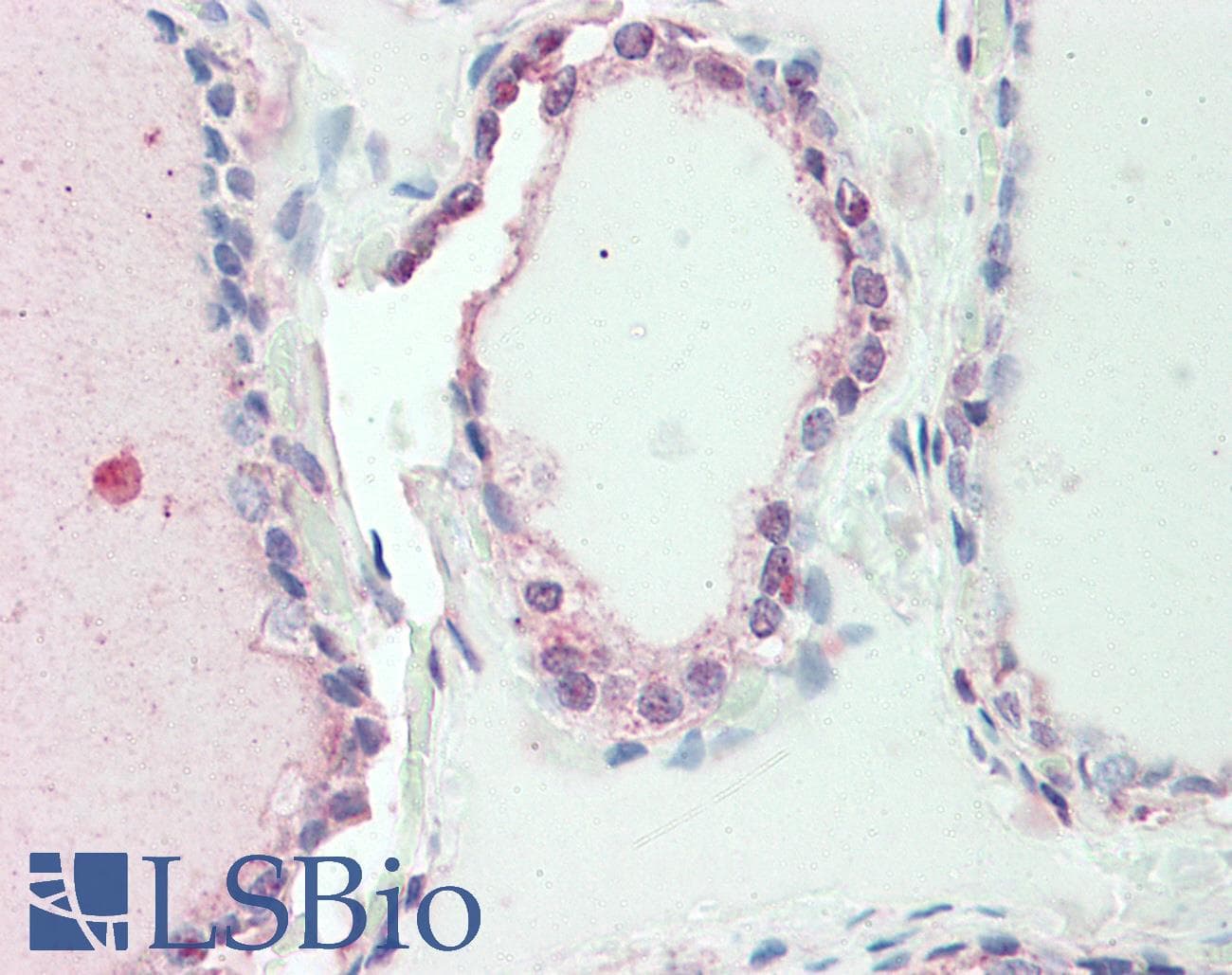 SP2 Antibody (aa180-229)