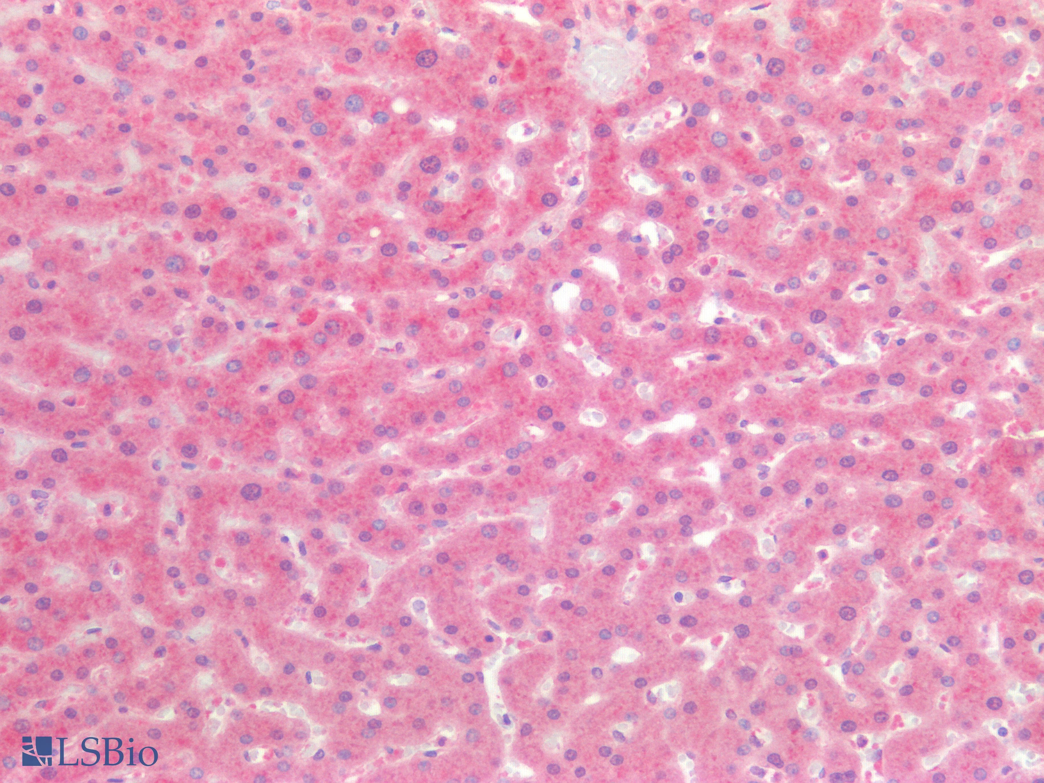 IHC-plus™ ABCB4 / MDR3 Antibody (Concentrated)