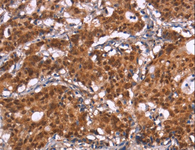 HIPK1 Antibody