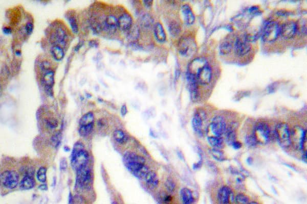 Polyclonal Rabbit anti-Human CASP2 / Caspase 2 Antibody (Lys136, IHC, WB)
