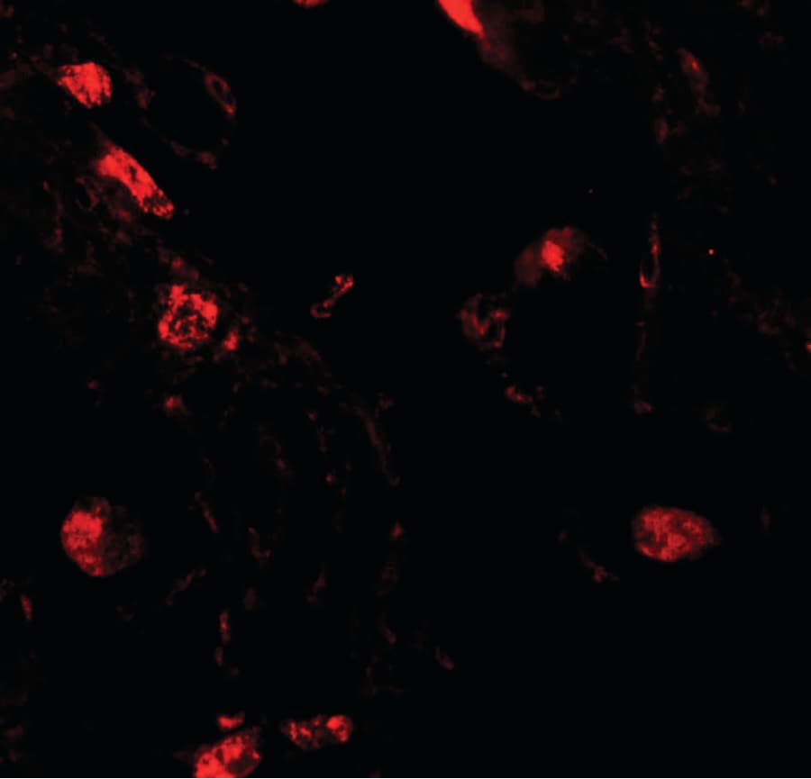 IHC-plus™ Polyclonal Rabbit anti-Human RILPL2 Antibody (IHC, IF, WB)