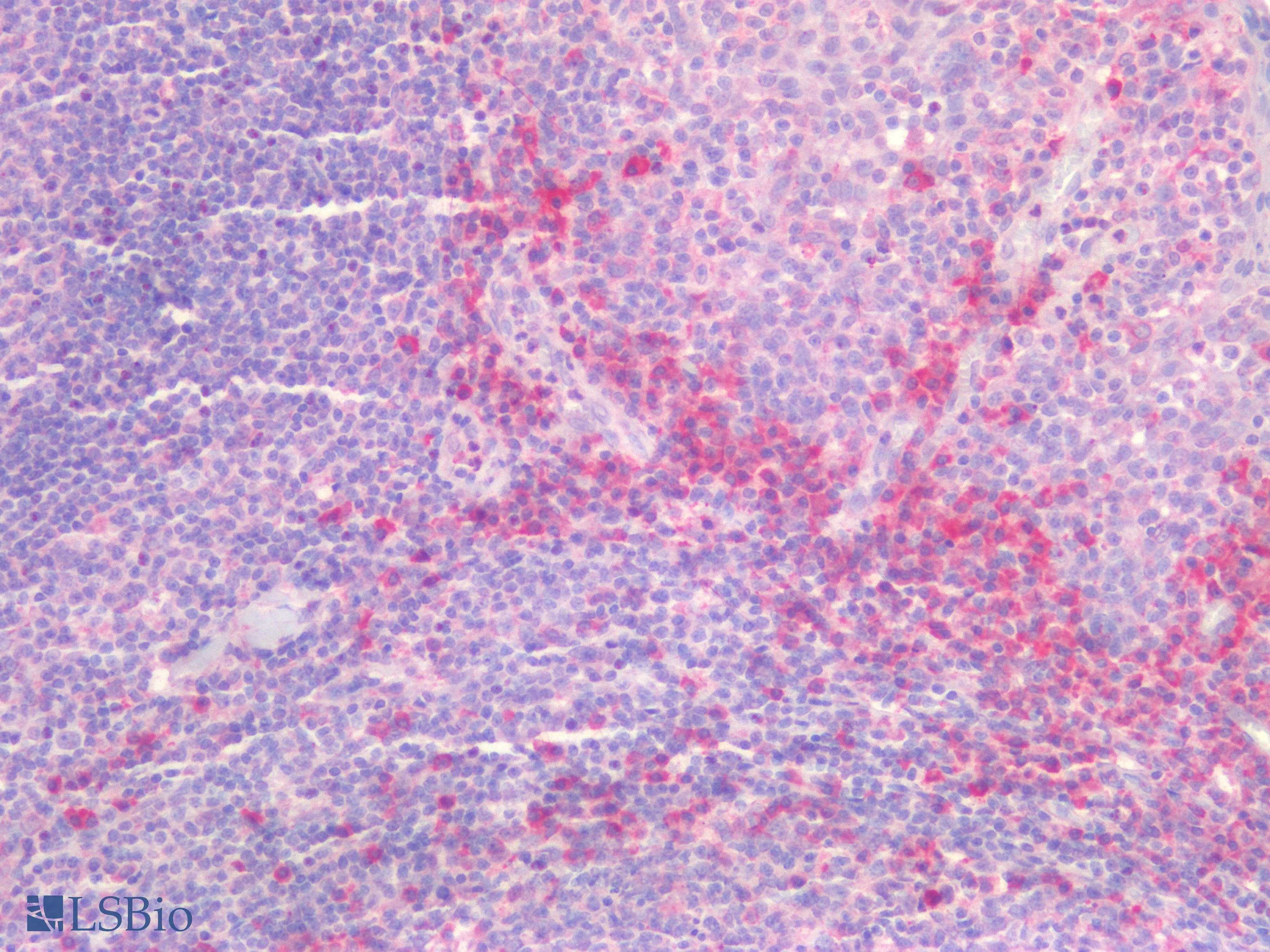 PathPlus™ Polyclonal Rabbit anti-Human IFIH1 / MDA5 Antibody (IHC)