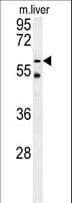 TYSND1 Antibody (aa522-550)
