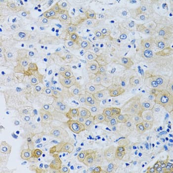 SLC4A5 / NBC4 Antibody