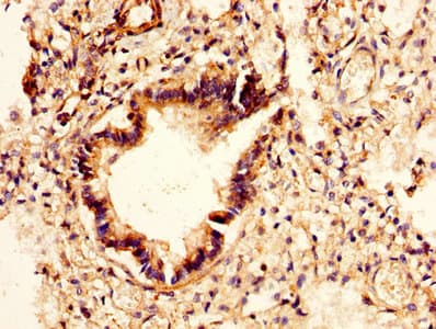 YKL39 / CHI3L2 Antibody