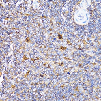 TOLLIP Antibody