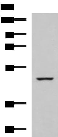 IP6K2 Antibody