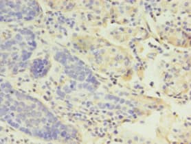 LYZ / Lysozyme Antibody (aa19-148)