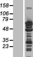 MAP2 Protein (Over-Expression Lysate Myc-DDK (Flag))