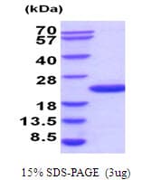 Human UBE2G2 Protein (Recombinant His)