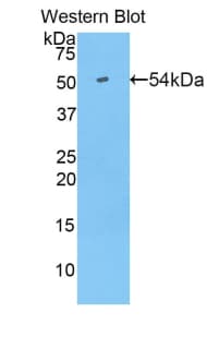 FCGR3A / CD16A Antibody (aa5-240)