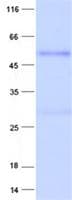 Human NEUROD2 Protein (Recombinant His, N-Terminal)