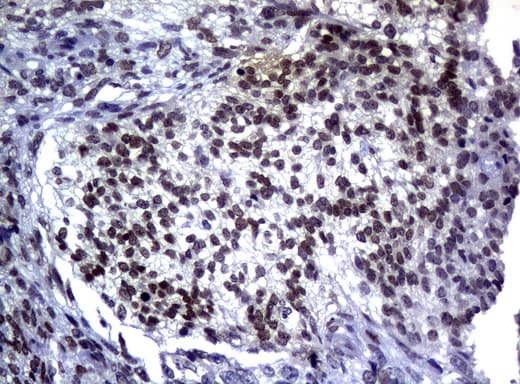 MGMT Antibody (clone UMAB56)