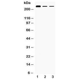 Polyclonal Rabbit anti-Human TECTA Antibody (IHC, WB)