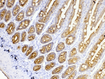 Polyclonal Rabbit anti-Human KRT18 / CK18 / Cytokeratin 18 Antibody (IHC, WB)