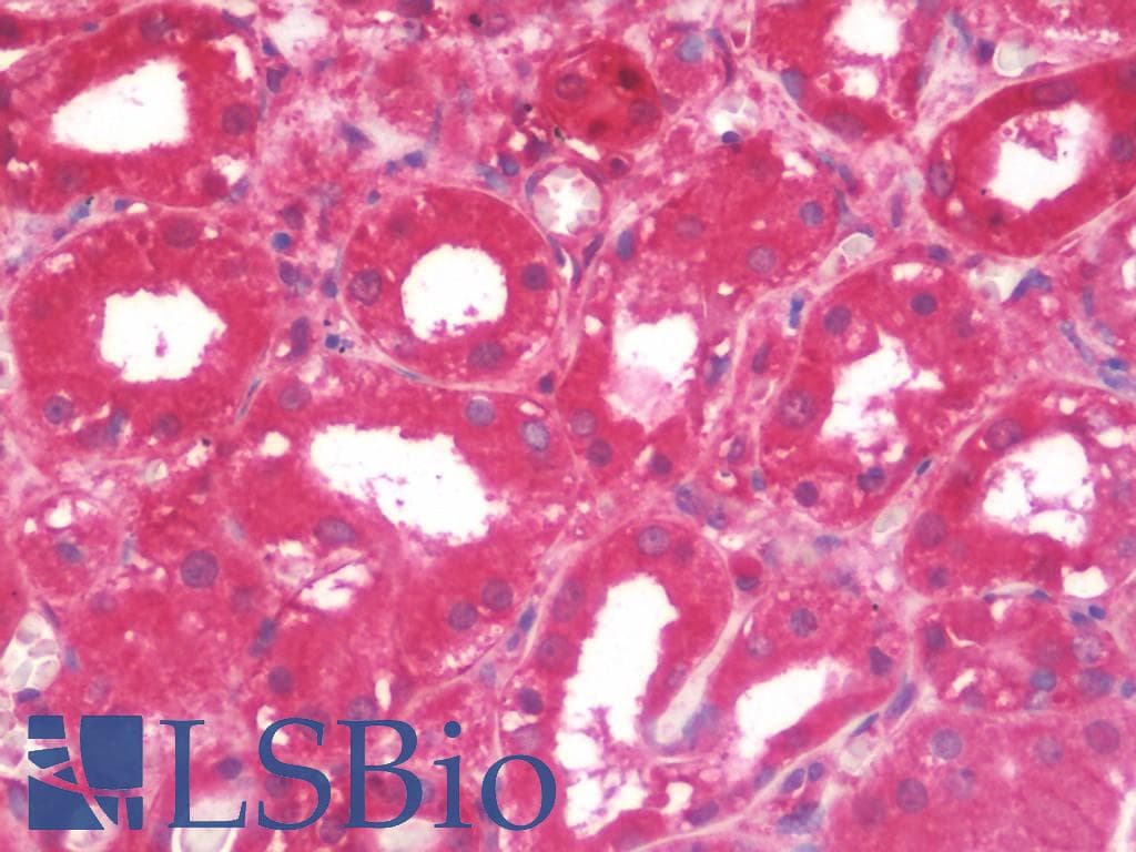 IHC-plus™ ITGB1 / Integrin Beta 1 / CD29 Antibody (clone 4B7R, Azide-free)