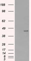 PRKAR1A Antibody (clone OTI6C7)