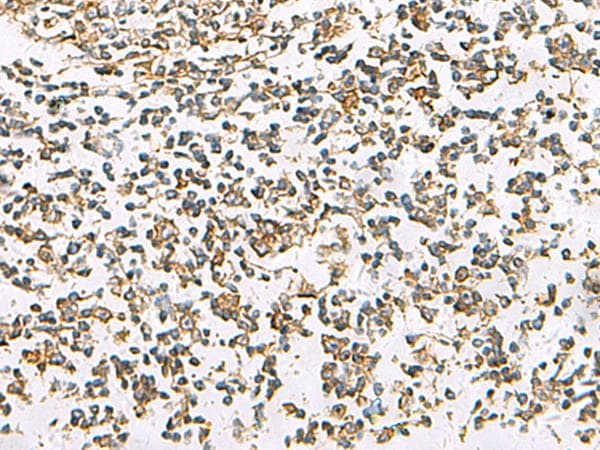 SLC16A1 / MCT1 Antibody