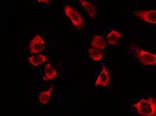 KRT18 / CK18 / Cytokeratin 18 Antibody
